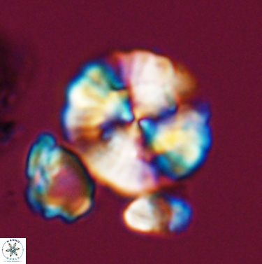Cyclagelosphaera brezae 11440