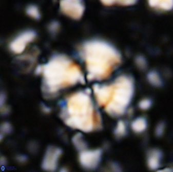 Cyclagelosphaera brezae 33284