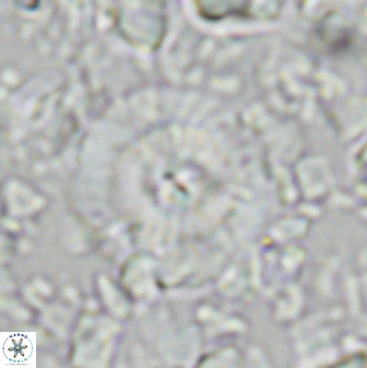 Cyclagelosphaera brezae 33288
