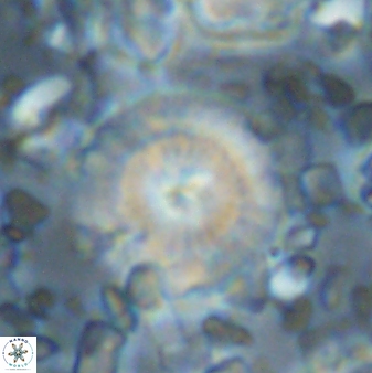 Cyclagelosphaera brezae 33289