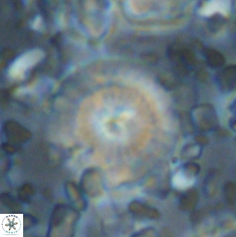 Cyclagelosphaera brezae 33290