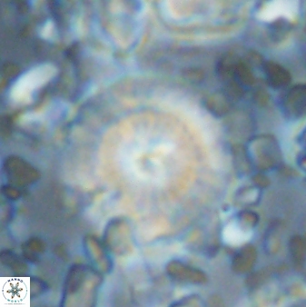 Cyclagelosphaera brezae 33291