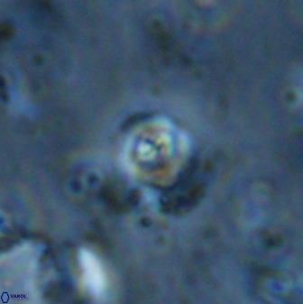 Cyclagelosphaera casarubrensis 48181