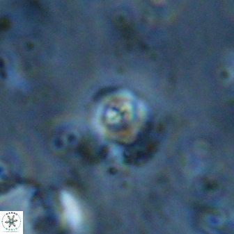 Cyclagelosphaera casarubrensis 48181