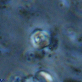 Cyclagelosphaera casarubrensis 48182