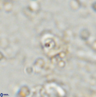 Cyclagelosphaera casarubrensis 48183