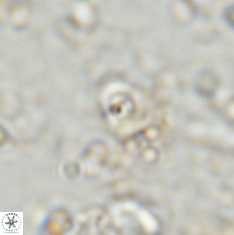 Cyclagelosphaera casarubrensis 48183