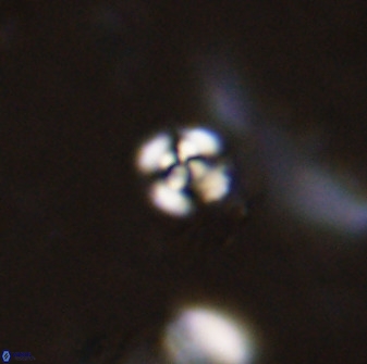 Cyclagelosphaera casarubrensis 48184