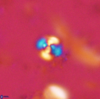 Cyclagelosphaera casarubrensis 48185