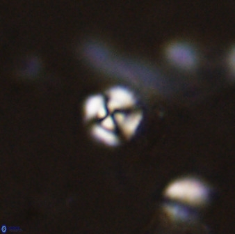 Cyclagelosphaera casarubrensis 48186