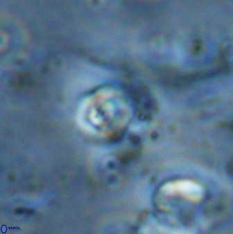 Cyclagelosphaera casarubrensis 48188