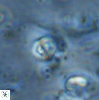 Cyclagelosphaera casarubrensis 48188