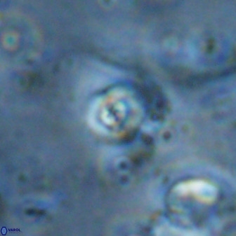 Cyclagelosphaera casarubrensis 48189