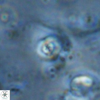 Cyclagelosphaera casarubrensis 48189