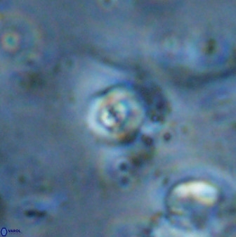 Cyclagelosphaera casarubrensis 48190