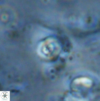 Cyclagelosphaera casarubrensis 48190