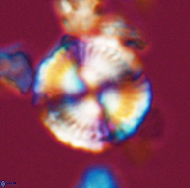 Cyclagelosphaera centrumelliptica 12452