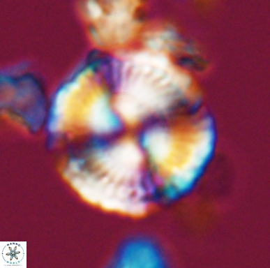 Cyclagelosphaera centrumelliptica 12452