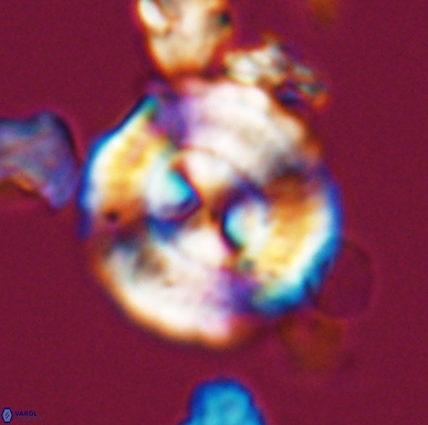Cyclagelosphaera centrumelliptica 12453