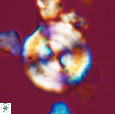 Cyclagelosphaera centrumelliptica 12453