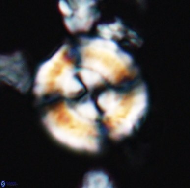 Cyclagelosphaera centrumelliptica 12454