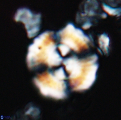 Cyclagelosphaera centrumelliptica 12455