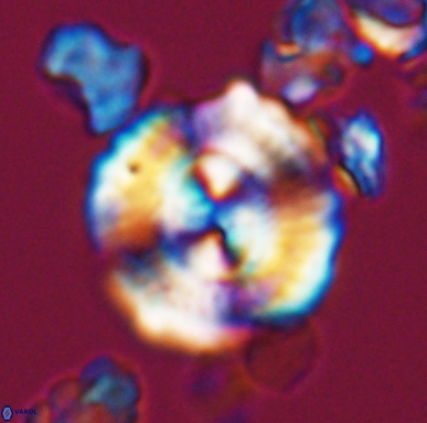 Cyclagelosphaera centrumelliptica 12456