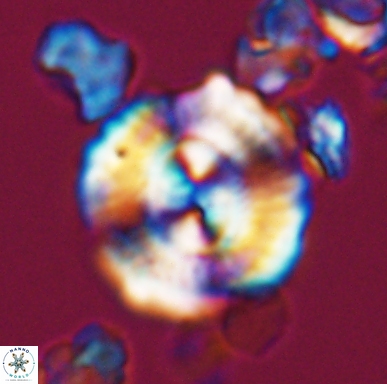 Cyclagelosphaera centrumelliptica 12454