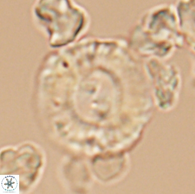 Cyclagelosphaera centrumelliptica 12459
