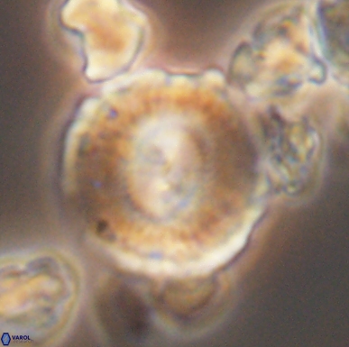 Cyclagelosphaera centrumelliptica 12460