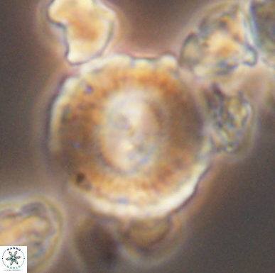 Cyclagelosphaera centrumelliptica 12460