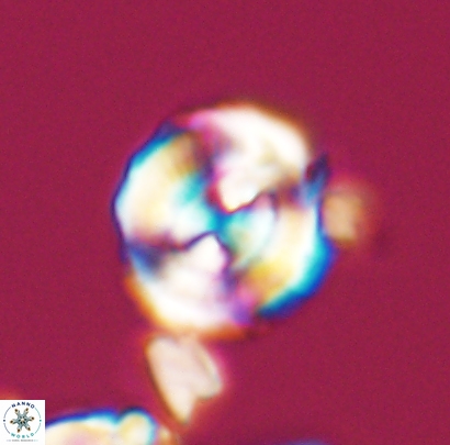 Cyclagelosphaera centrumelliptica 12693