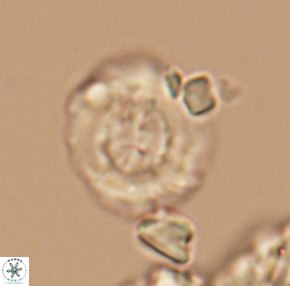 Cyclagelosphaera centrumelliptica 12694