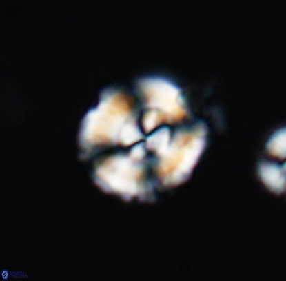 Cyclagelosphaera centrumelliptica 12710