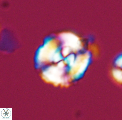 Cyclagelosphaera centrumelliptica 12711
