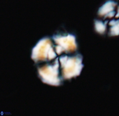Cyclagelosphaera centrumelliptica 12712