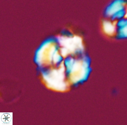Cyclagelosphaera centrumelliptica 12713