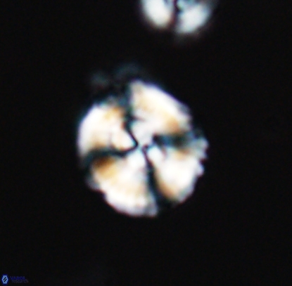 Cyclagelosphaera centrumelliptica 12714