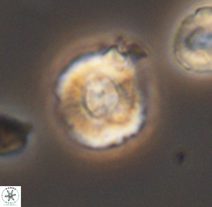 Cyclagelosphaera centrumelliptica 12717