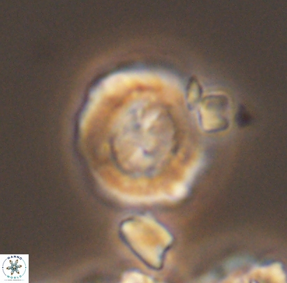 Cyclagelosphaera centrumelliptica 12696