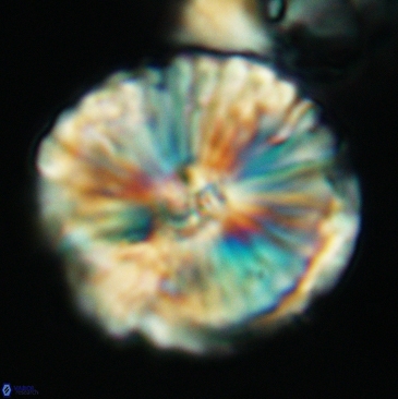 Cyclagelosphaera deflandrei 3810