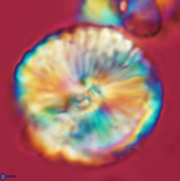 Cyclagelosphaera deflandrei 3811