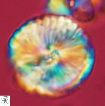 Cyclagelosphaera deflandrei 3811