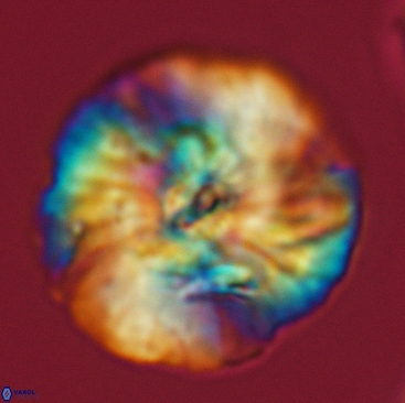 Cyclagelosphaera deflandrei 3817