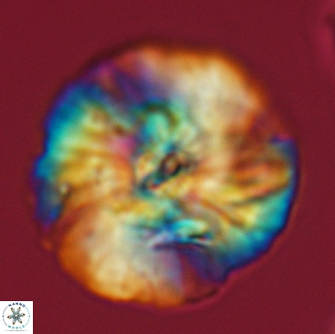 Cyclagelosphaera deflandrei 3817