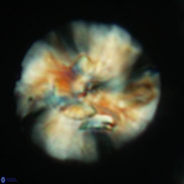 Cyclagelosphaera deflandrei 3816