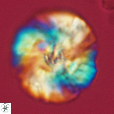 Cyclagelosphaera deflandrei 3818