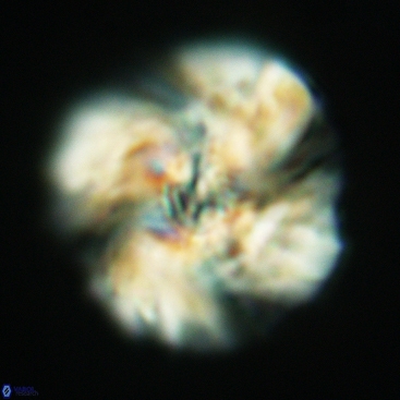 Cyclagelosphaera deflandrei 3819