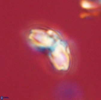 Cyclagelosphaera elevatocycla 62358