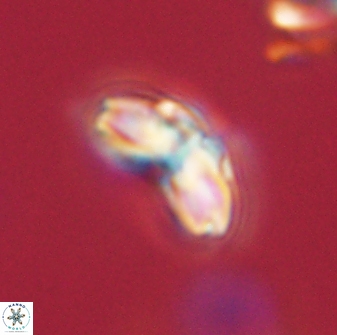 Cyclagelosphaera elevatocycla 62358